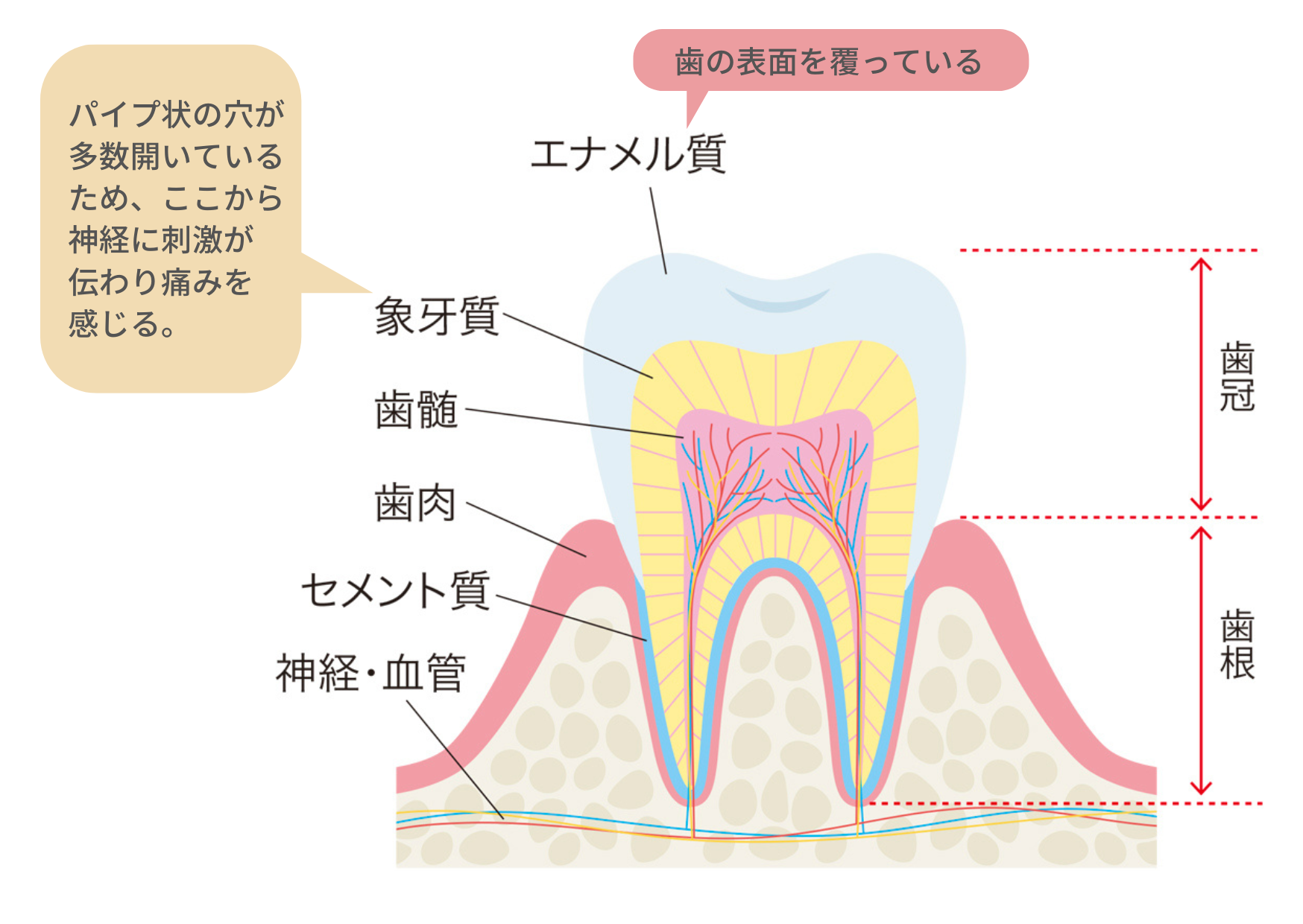 🧊知覚過敏🧊