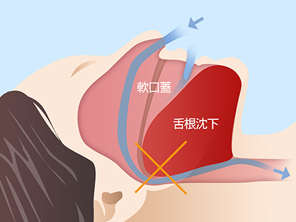 いびきは身体からの危険信号かもしれません～いびき・睡眠時無呼吸症候群～